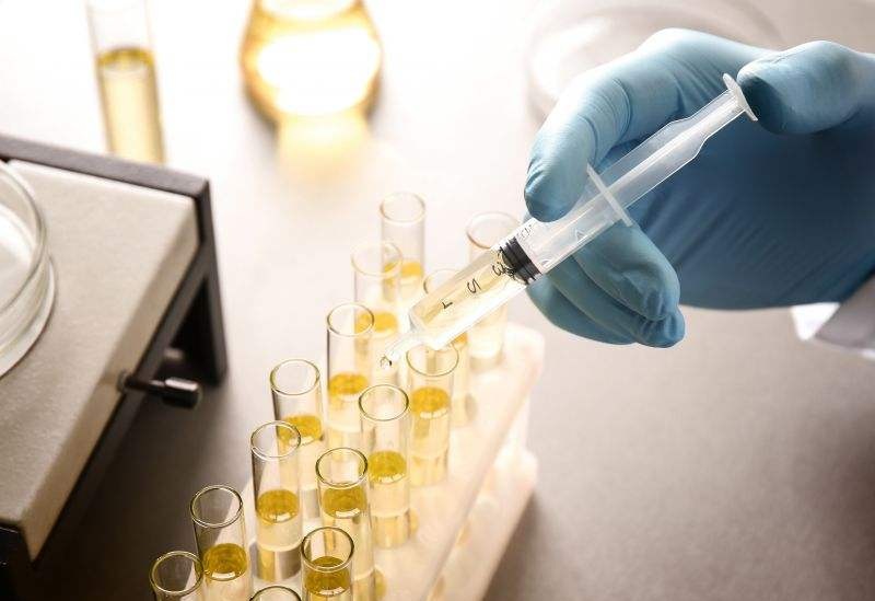 尿檢能檢測出來什么問題？