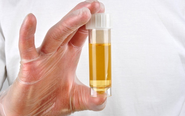 尿檢能檢測出來什么問題？