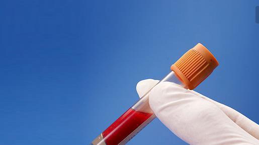 健康體檢一般檢查哪些項目？